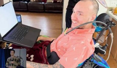 Beynine çip takılmıştı! Neuralink ölmekten korkmaması için uyardı…