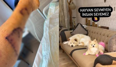 Evdeki diğer köpekten sahibini kıskanarak bacağını parçaladı